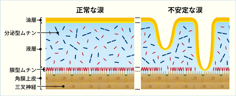 ドライアイ・正常な涙と不安定な涙