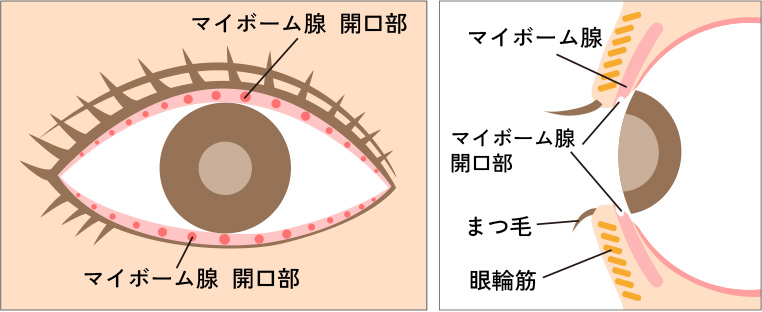 ドライアイとマイボーム腺開口部